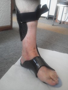 Orthèse releveur de pied dynamique InnovPulse sans chaussure