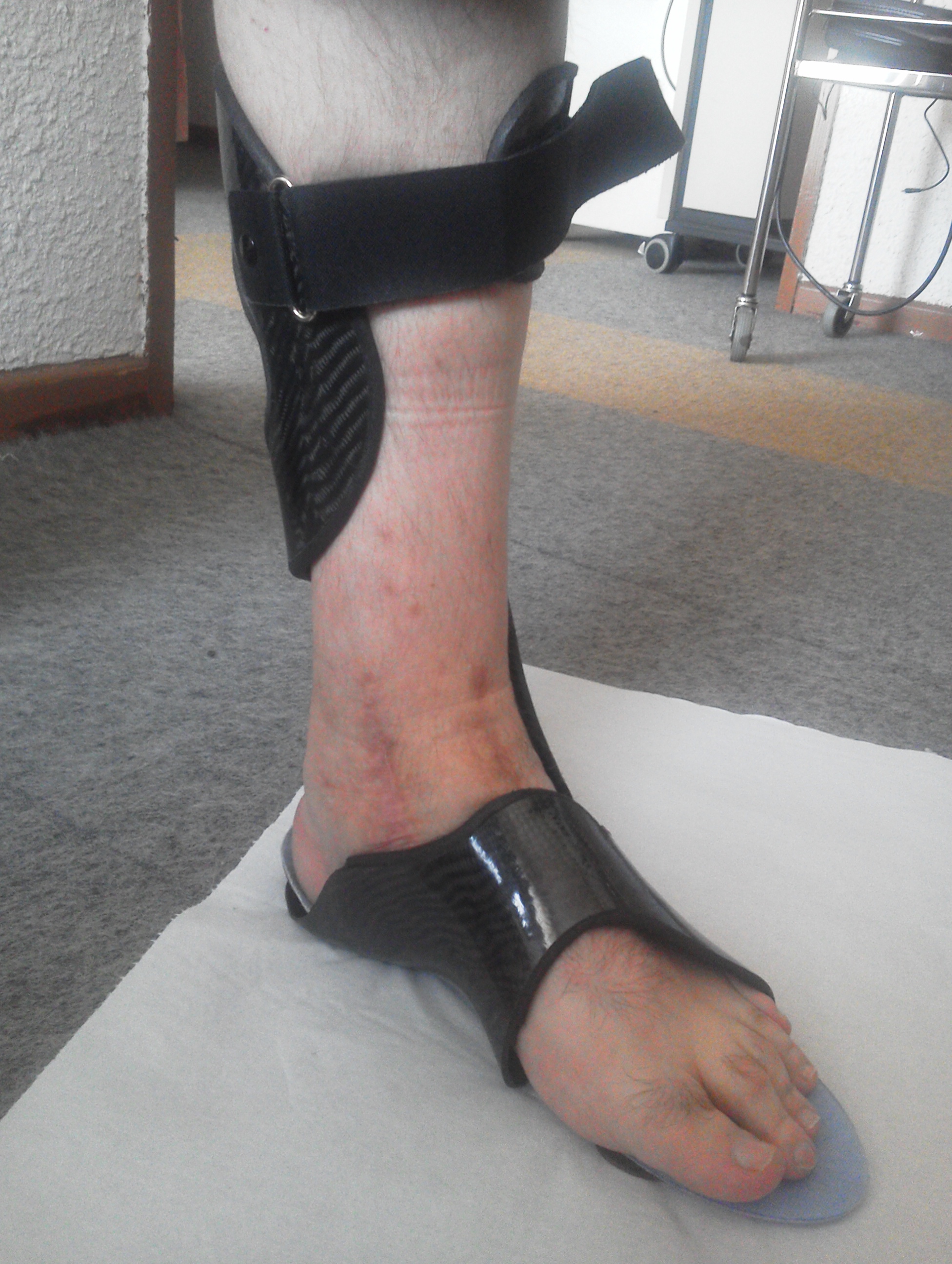 Dynamic Ankle Foot Orthosis InnovPulse without shoes